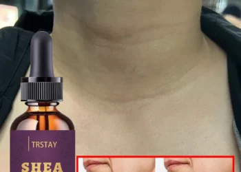 Effective Neck Lift Cream for Youthful Skin and Smooth Radiance Results