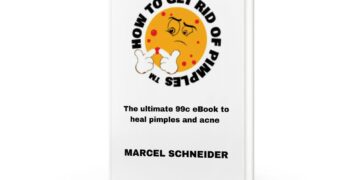 🌟 Struggling with pimples and acne? You’re definitely not alone! 🌟   